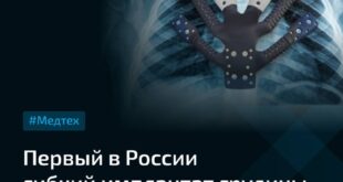 Революция в медицинских технологиях: создание гибкого имплантата грудины в России