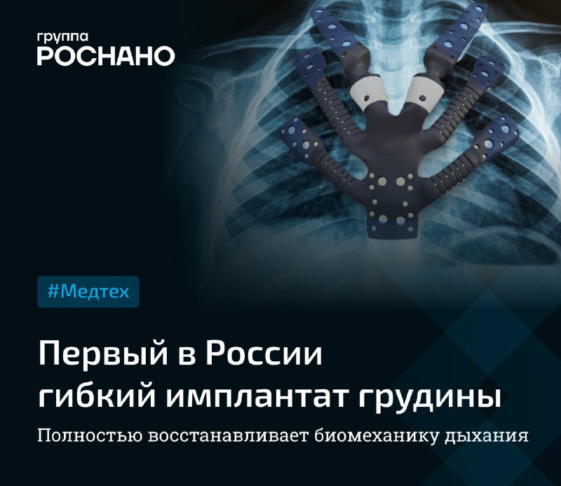 Революция в медицинских технологиях: создание гибкого имплантата грудины в России